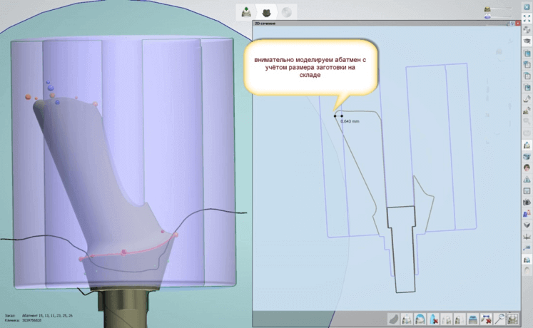 16 рекомендаций по CAD CAM моделированию ортопедических конструкций 4 - Фрезерный CAD/CAM центр Ортос Новости