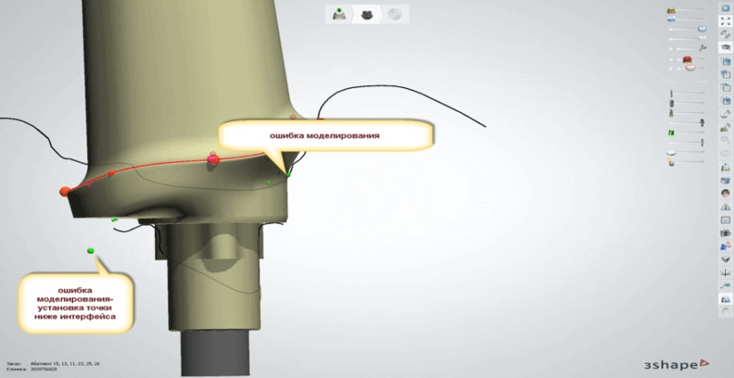 16 рекомендаций по CAD CAM моделированию ортопедических конструкций 5 - Фрезерный CAD/CAM центр Ортос Новости