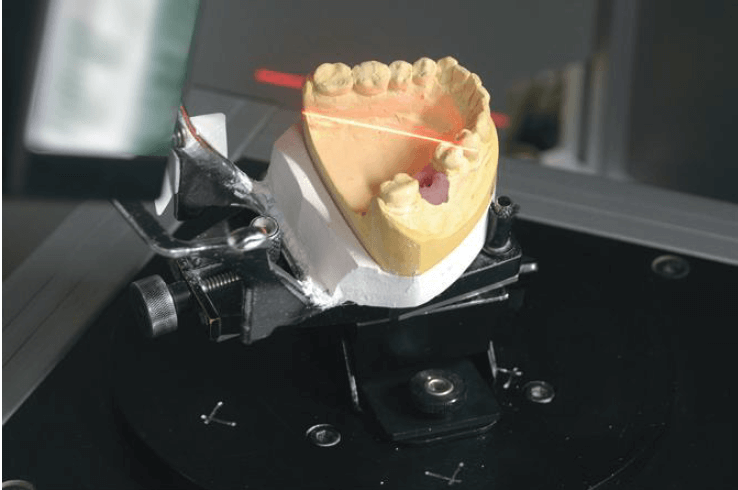 История развития CAD/CAM технологий в ортопедической стоматологии 3 - Фрезерный CAD/CAM центр Ортос Новости