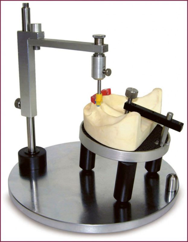 Изготовление бюгельных протезов на основе параллелометрии 8 - Фрезерный CAD/CAM центр Ортос Новости