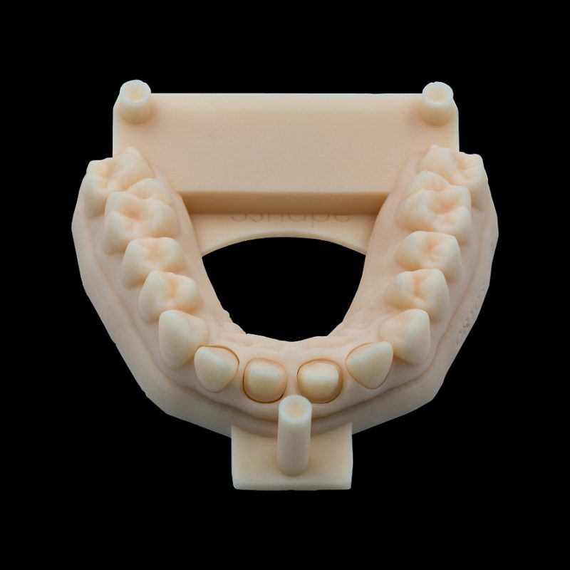 Улучшили качество и точность разборных и неразборных дентальных моделей из стоматологического фотополимера 2 - Фрезерный CAD/CAM центр Ортос Новости