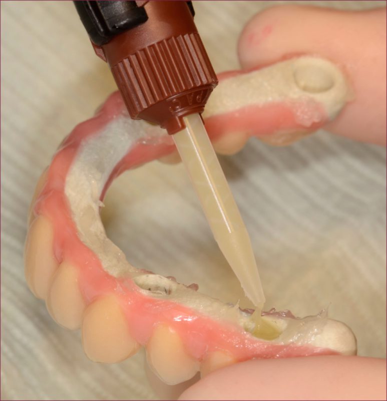 Классификация материалов в ортопедической стоматологии: стеклоиономерный цемент 13 - Фрезерный CAD/CAM центр Ортос Полезные статьи