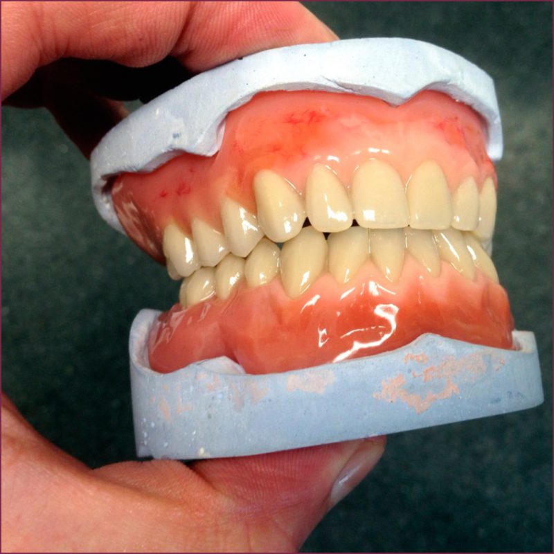 Коррекция зубных протезов - как правильно проводить 3 - Фрезерный CAD/CAM центр Ортос Полезные статьи