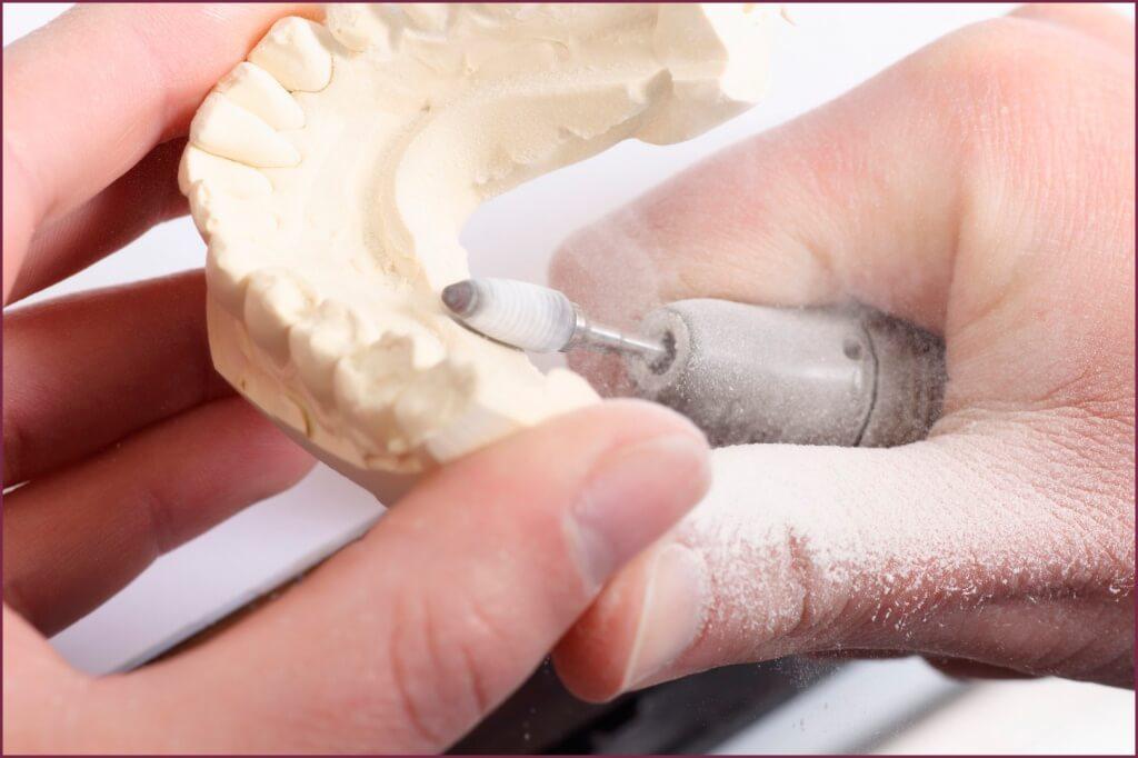 Проверка протеза после создания 4 - Фрезерный CAD/CAM центр Ортос Новости