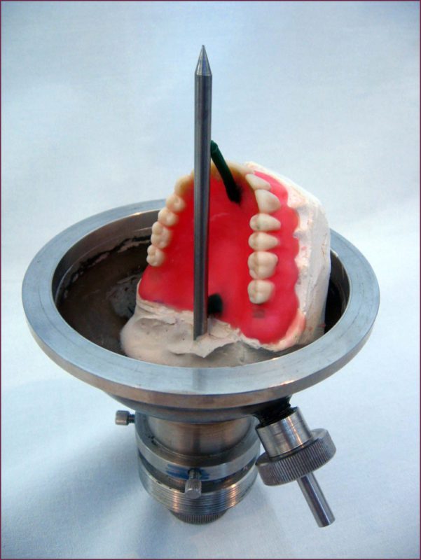 проверка зубных протезов (14).jpg