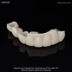 Фотографии каркаса из ZrO2 A1 на культях естественных зубов 2 - Фрезерный CAD/CAM центр Ортос Новости