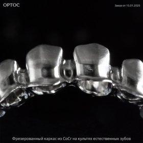 Фрезерованный каркас из CoCr на культях естественных зубов 1 - Фрезерный CAD/CAM центр Ортос Новости
