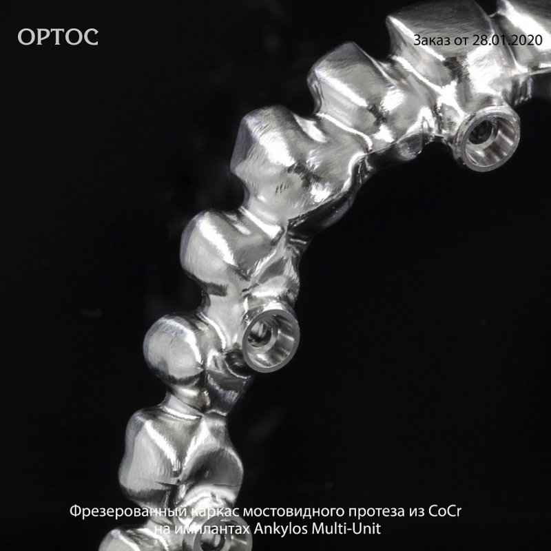 Фотографии фрезерованного каркаса мостовидного протеза из CoCr на Ankylos Multi-Unit 1 - Фрезерный CAD/CAM центр Ортос Новости
