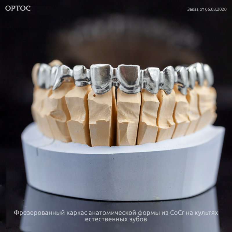 Фотография фрезерованного каркаса анатомической формы из CoCr 1 - Фрезерный CAD/CAM центр Ортос Новости