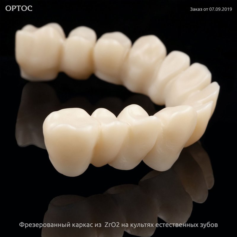 Фрезерованный каркас из ZrO2 A1 на культях естественных зубов 2 - Фрезерный CAD/CAM центр Ортос Новости
