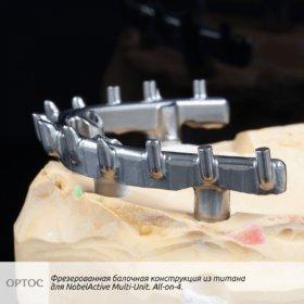 Фотографии фрезерованной балочной конструкции с уровня имплантата из Ti для системы NobelActive Multi-Unit 3 - Фрезерный CAD/CAM центр Ортос Новости