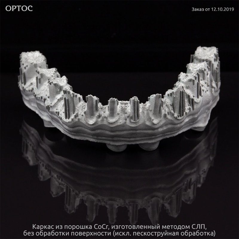 Фотографии каркаса, созданного методом СЛП из CoCr порошка 2 - Фрезерный CAD/CAM центр Ортос Новости