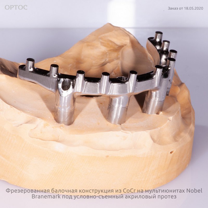 Фрезерованная балочная конструкция из CoCr под акриловый протез 4 - Фрезерный CAD/CAM центр Ортос Новости