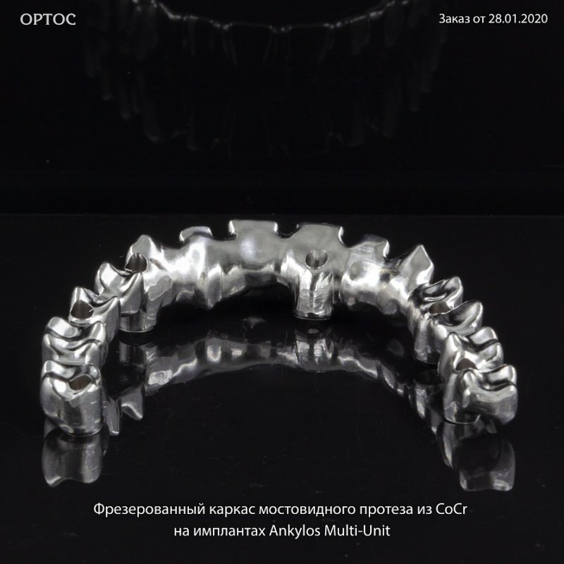 Фотографии фрезерованного каркаса мостовидного протеза из CoCr на Ankylos Multi-Unit 2 - Фрезерный CAD/CAM центр Ортос Новости