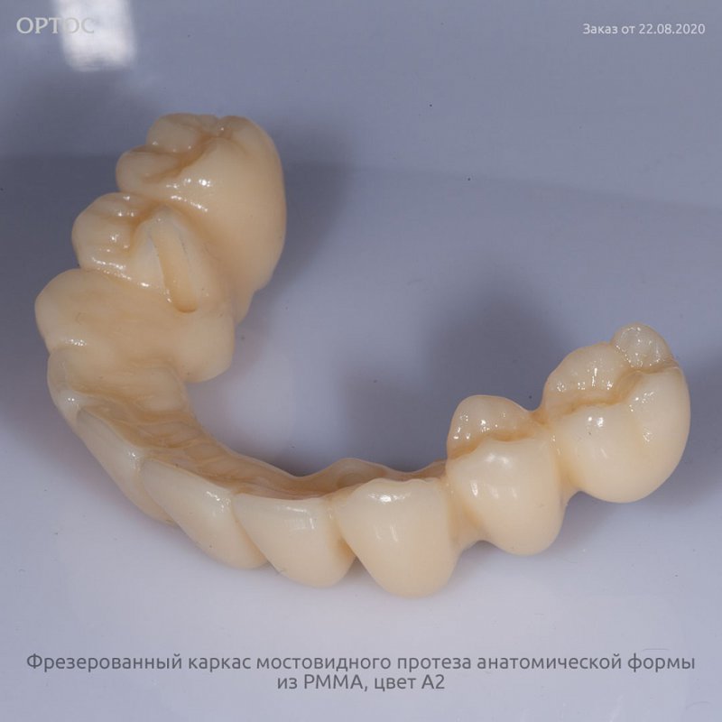 Фотографии каркаса протеза из PMMA A2 4 - Фрезерный CAD/CAM центр Ортос Новости
