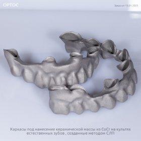 Фотографии каркасов под нанесение из CoCr, метод СЛП 1 - Фрезерный CAD/CAM центр Ортос Новости