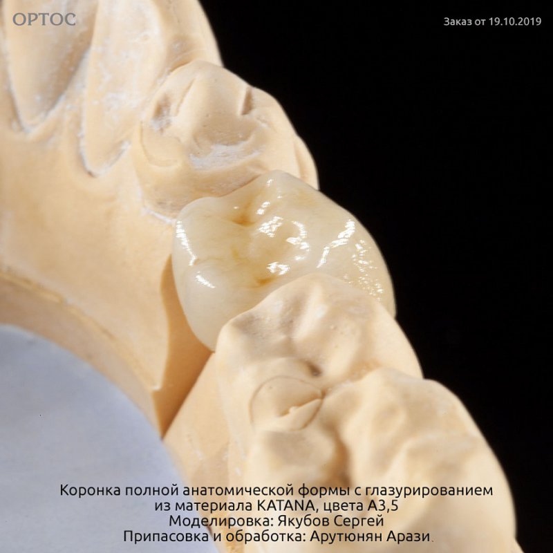 Коронка полной анатомической формы из KATANA A3,5 с глазурированием 2 - Фрезерный CAD/CAM центр Ортос Новости