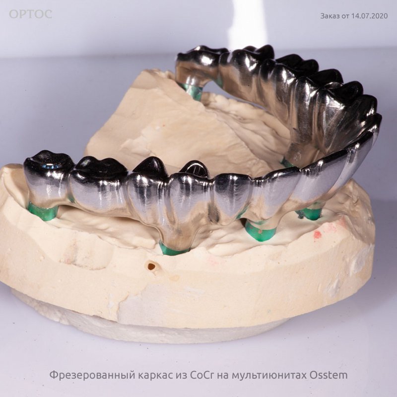 Фотографии каркаса из CoCr на мультиюнитах Osstem 1 - Фрезерный CAD/CAM центр Ортос Новости
