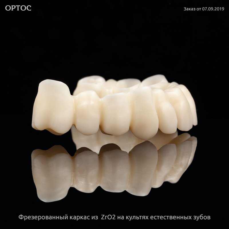Фрезерованный каркас из ZrO2 A1 на культях естественных зубов 3 - Фрезерный CAD/CAM центр Ортос Новости