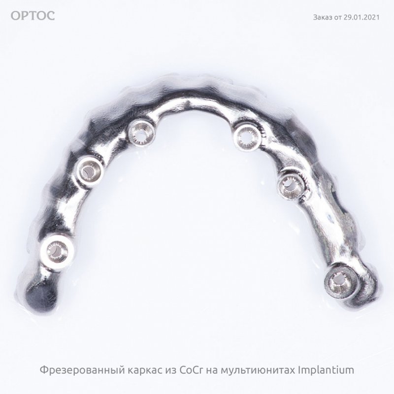 Фрезерованный каркас из CoCr на мультиюнитах Implantium 3 - Фрезерный CAD/CAM центр Ортос Новости