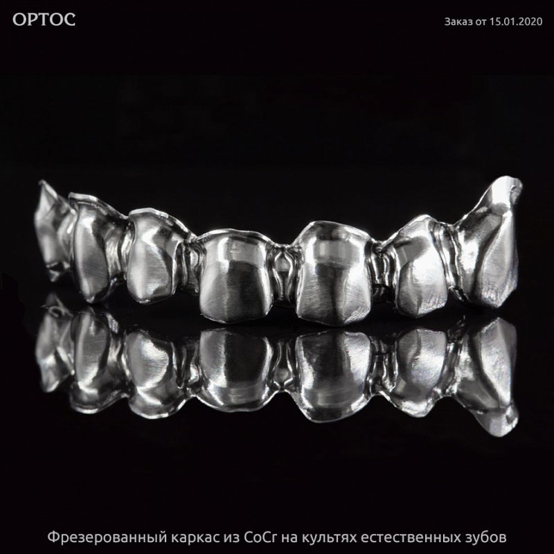 Фрезерованный каркас из CoCr на культях естественных зубов 2 - Фрезерный CAD/CAM центр Ортос Новости