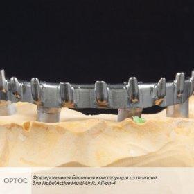 Фотографии фрезерованной балочной конструкции с уровня имплантата из Ti для системы NobelActive Multi-Unit 2 - Фрезерный CAD/CAM центр Ортос Новости