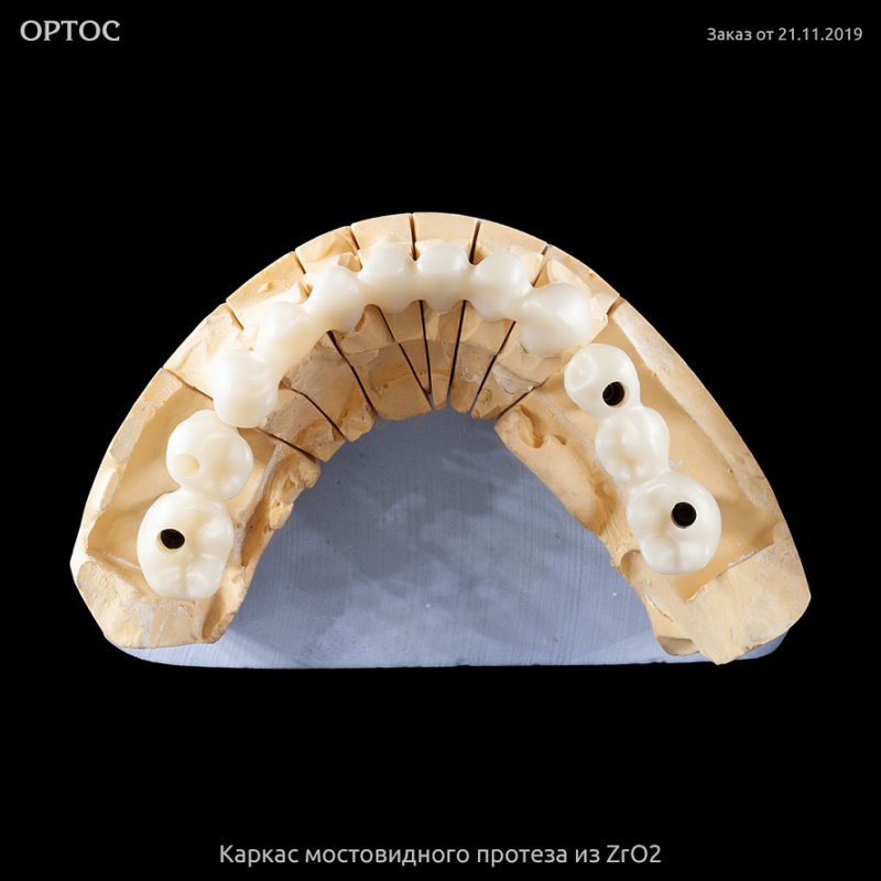 Фотографии каркаса мостовидного протеза из ZrO2 B1 2 - Фрезерный CAD/CAM центр Ортос Новости