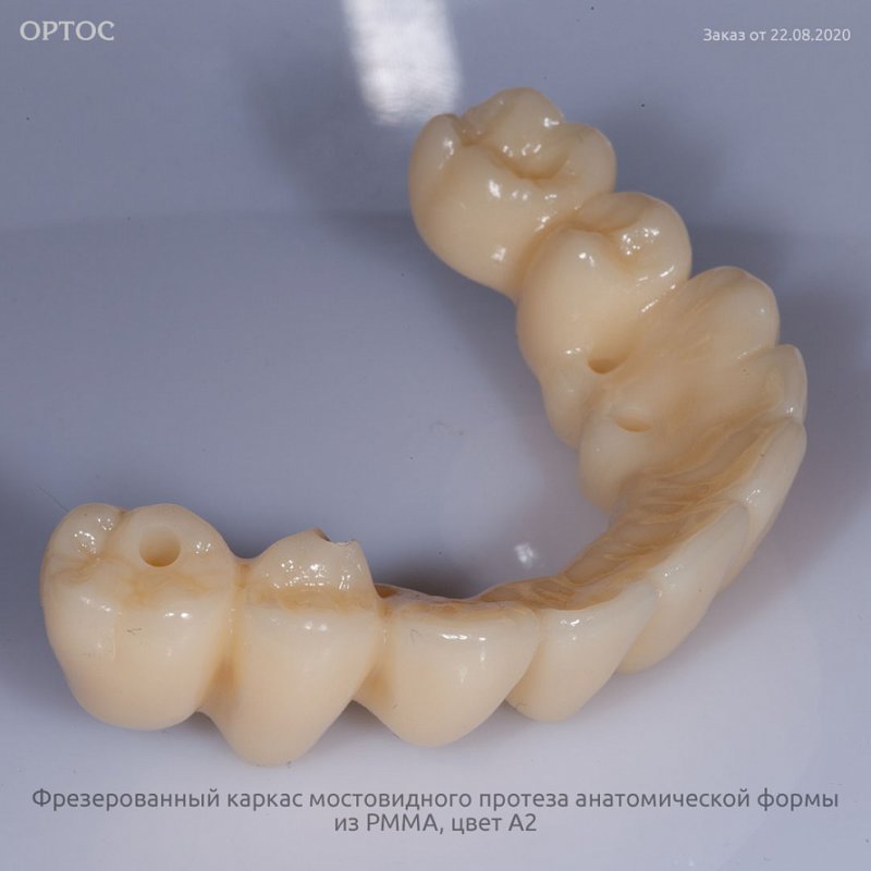 Фотографии каркаса протеза из PMMA A2 2 - Фрезерный CAD/CAM центр Ортос Новости