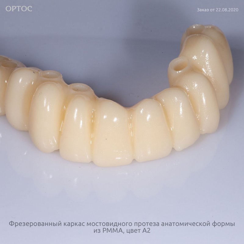 Фотографии каркаса протеза из PMMA A2 3 - Фрезерный CAD/CAM центр Ортос Новости