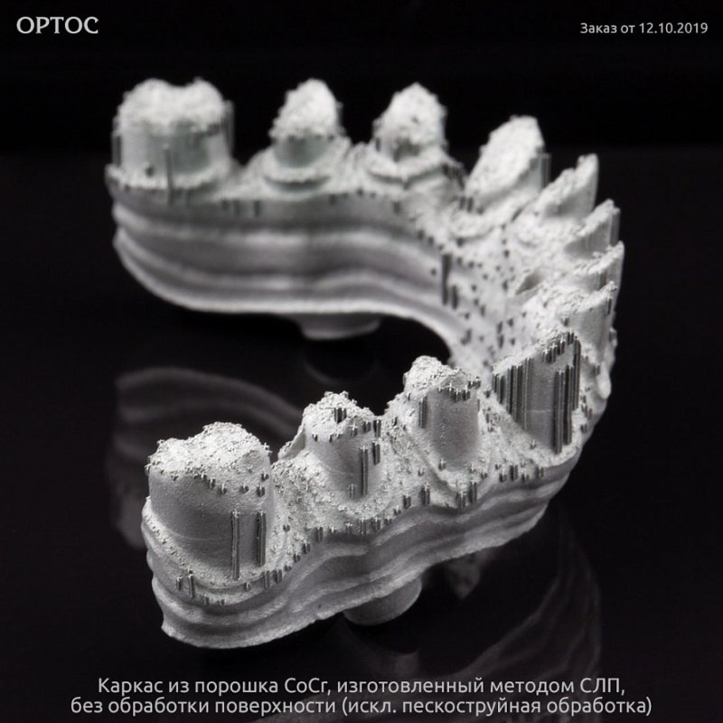 Фотографии каркаса, созданного методом СЛП из CoCr порошка 4 - Фрезерный CAD/CAM центр Ортос Новости