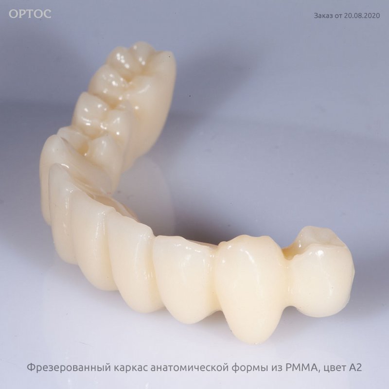 Фотографии каркаса протеза анатомической формы из PMMA A2 3 - Фрезерный CAD/CAM центр Ортос Новости