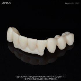 Фотографии каркаса из ZrO2 A1 на культях естественных зубов 1 - Фрезерный CAD/CAM центр Ортос Новости