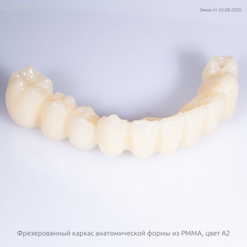 Фотографии каркаса протеза анатомической формы из PMMA A2 1 - Фрезерный CAD/CAM центр Ортос Новости