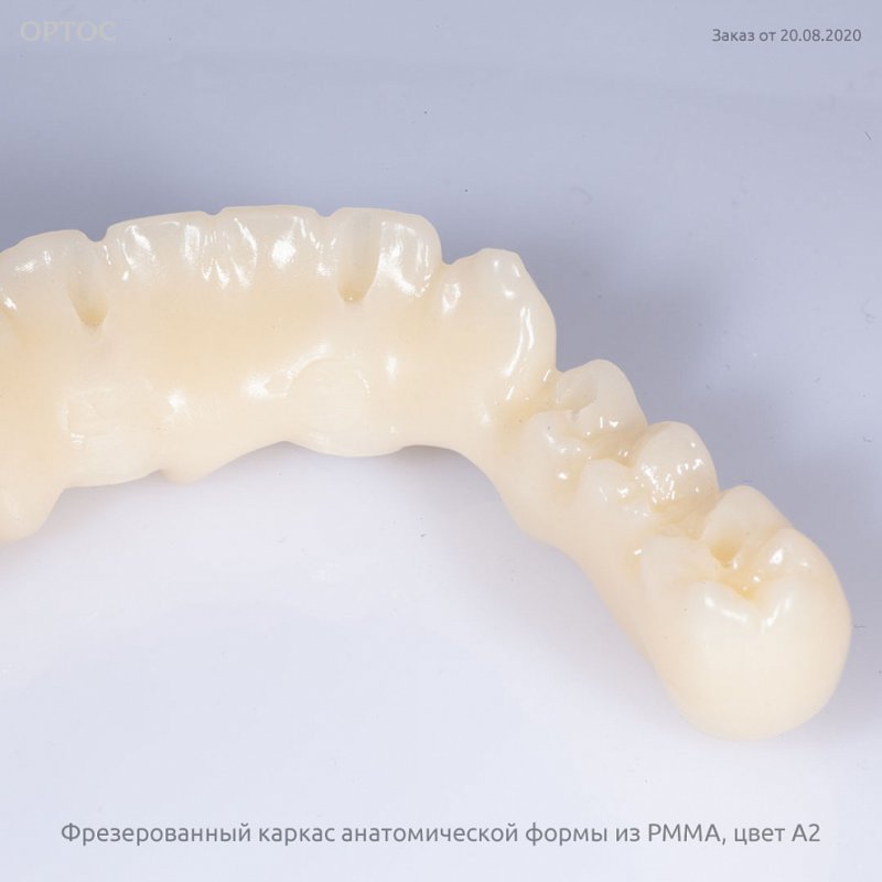 Фотографии каркаса протеза анатомической формы из PMMA A2 2 - Фрезерный CAD/CAM центр Ортос Новости