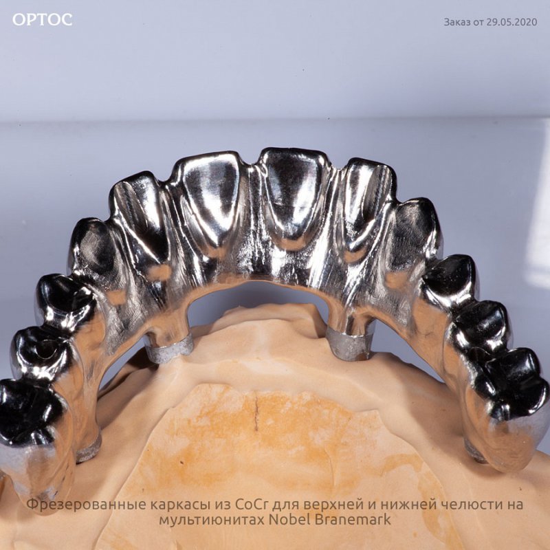 Фрезерованные каркасы из CoCr на мультиюнитах Nobel Branemark 5 - Фрезерный CAD/CAM центр Ортос Новости