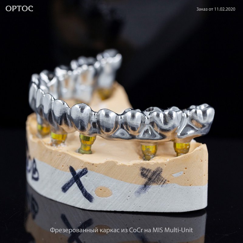 Фотографии фрезерованного каркаса мостовидного протеза из CoCr на MIS Multi-Unit 3 - Фрезерный CAD/CAM центр Ортос Новости