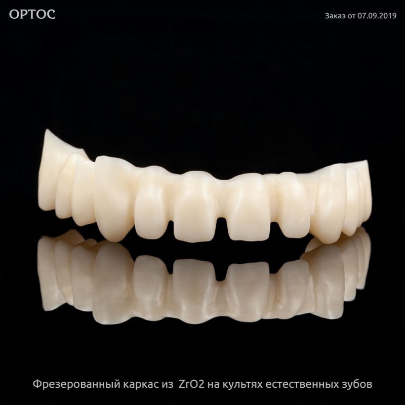 Фрезерованный каркас из ZrO2 A1 на культях естественных зубов 1 - Фрезерный CAD/CAM центр Ортос Новости