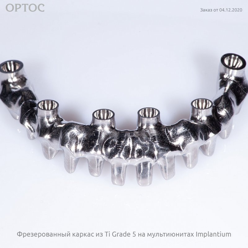 Фотографии фрезерованного каркаса из Ti на мультиюнитах Implantium 4 - Фрезерный CAD/CAM центр Ортос Новости