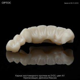 Фотографии каркаса из ZrO2 A1 на культях естественных зубов 3 - Фрезерный CAD/CAM центр Ортос Новости