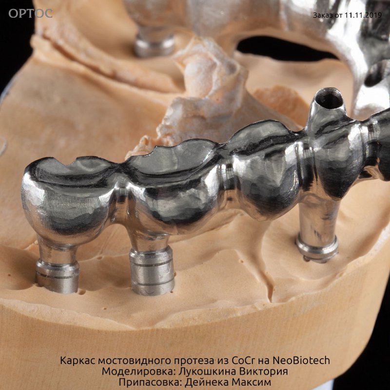 Фотографии каркаса протеза из CoCr на NeoBiotech 3 - Фрезерный CAD/CAM центр Ортос Новости