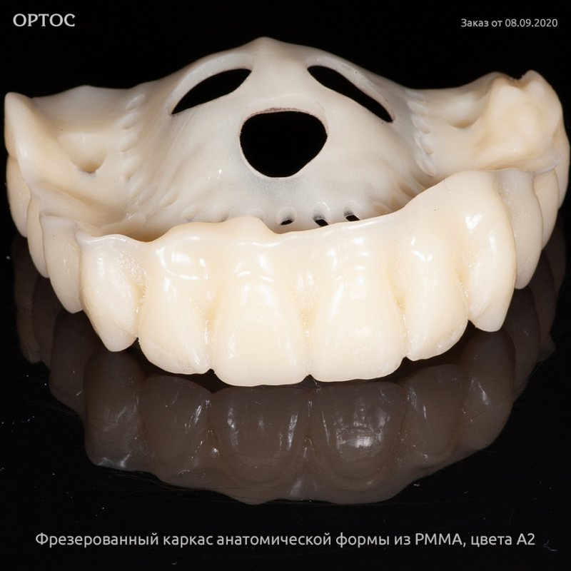 Фотографии фрезерованного каркаса из PMMA A2 3 - Фрезерный CAD/CAM центр Ортос Новости