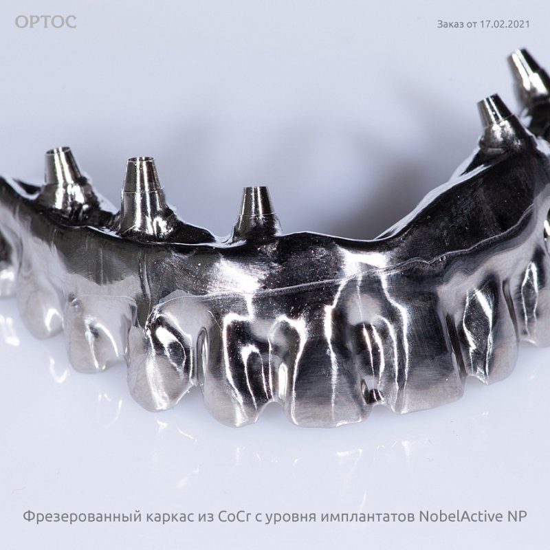 Фотографии фрезерованного каркаса на имплантатах NobelActive NP 9 - Фрезерный CAD/CAM центр Ортос Новости