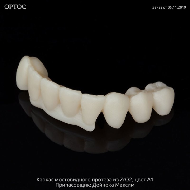 Фотографии каркаса из ZrO2 A1 на культях естественных зубов 4 - Фрезерный CAD/CAM центр Ортос Новости