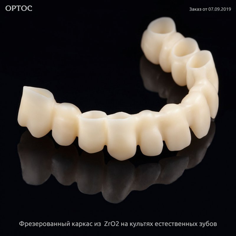 Фрезерованный каркас из ZrO2 A1 на культях естественных зубов 4 - Фрезерный CAD/CAM центр Ортос Новости