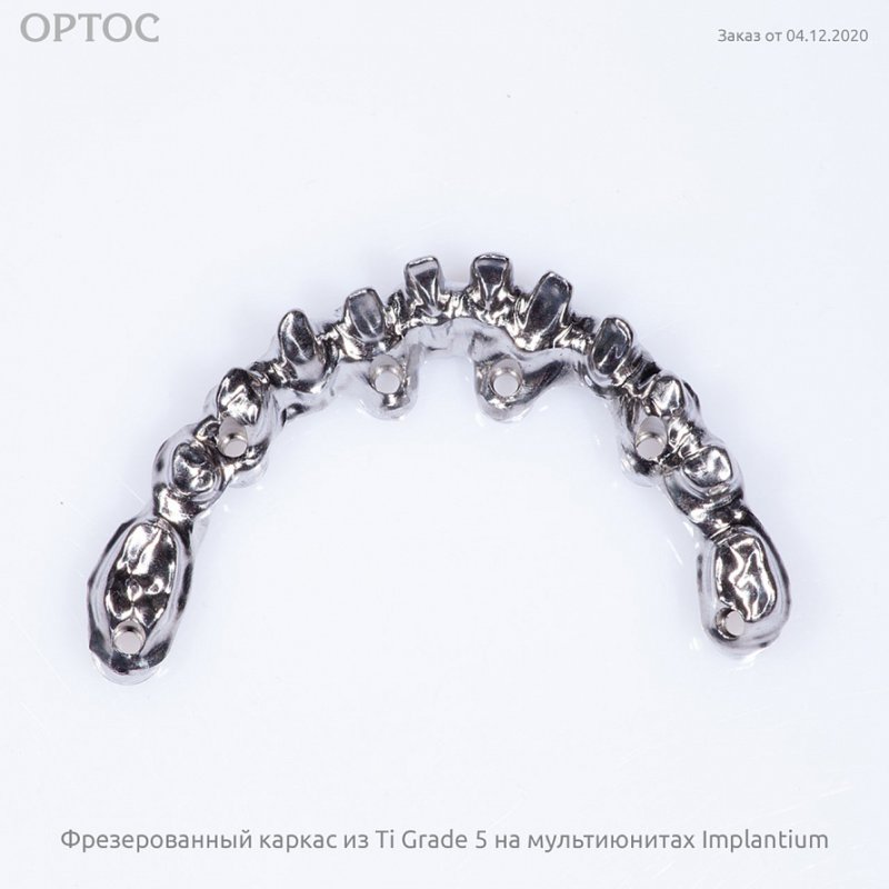 Фотографии фрезерованного каркаса из Ti на мультиюнитах Implantium 6 - Фрезерный CAD/CAM центр Ортос Новости