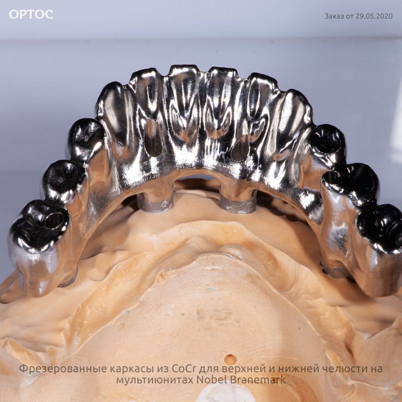 Фрезерованные каркасы из CoCr на мультиюнитах Nobel Branemark 7 - Фрезерный CAD/CAM центр Ортос Новости