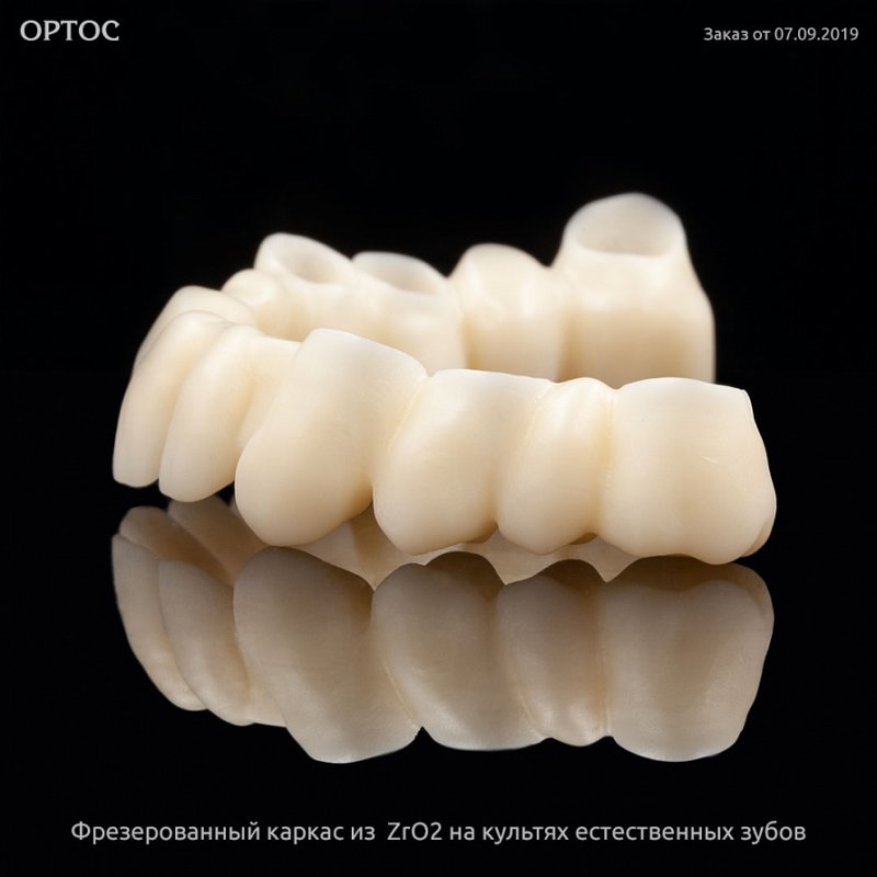 Фрезерованный каркас из ZrO2 A1 на культях естественных зубов 5 - Фрезерный CAD/CAM центр Ортос Новости
