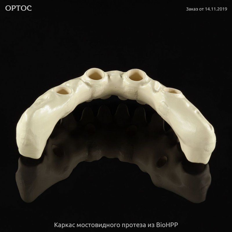 Фотографии каркаса из BioHPP 4 - Фрезерный CAD/CAM центр Ортос Новости