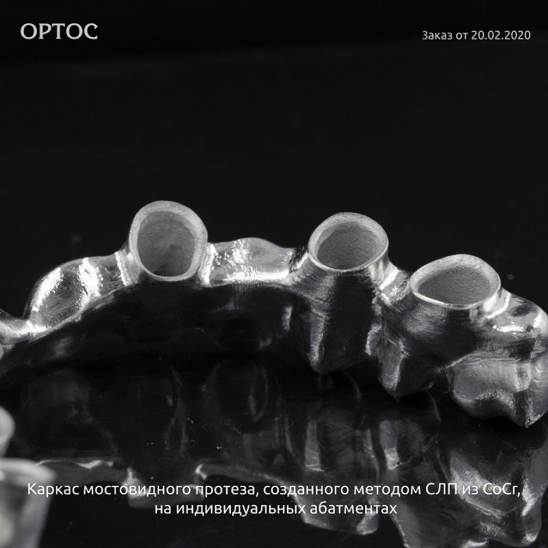 Фотографии каркаса мостовидного протеза, созданного методом СЛП из CoCr 9 - Фрезерный CAD/CAM центр Ортос Новости