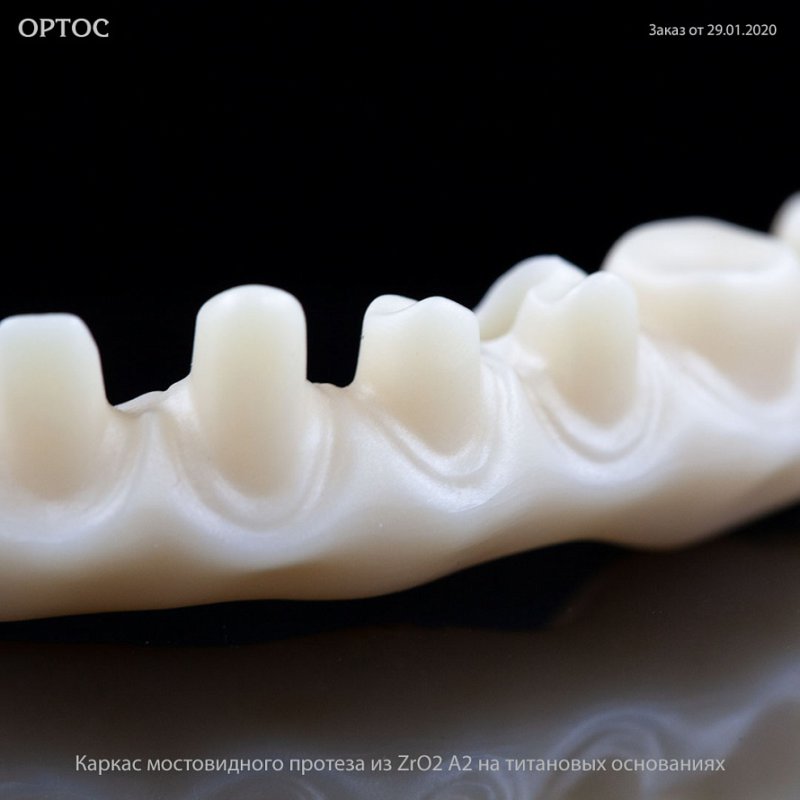 Фотографии каркаса мостовидного протеза из ZrO2 А2 10 - Фрезерный CAD/CAM центр Ортос Новости